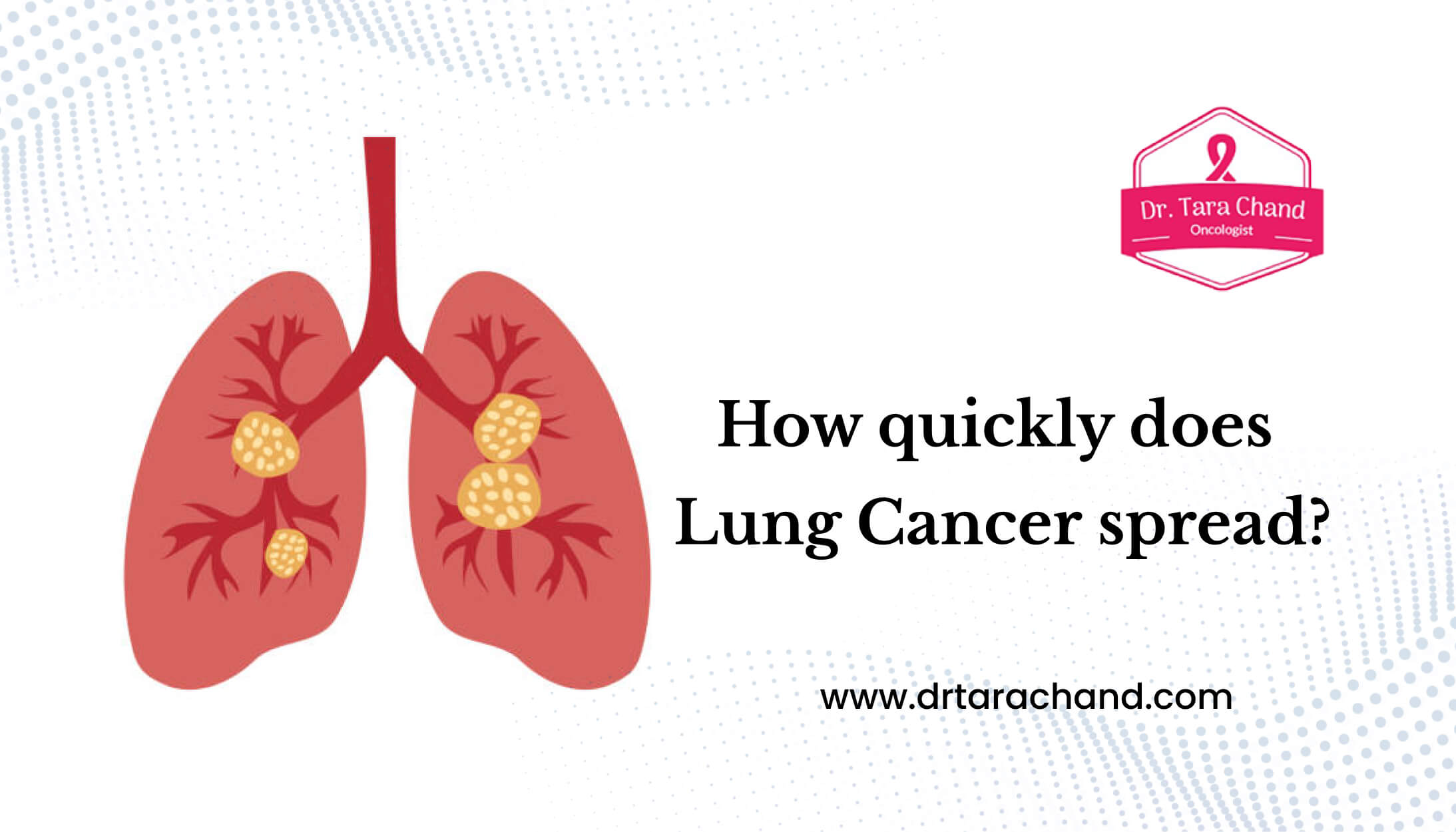 How quickly does lung cancer spread?