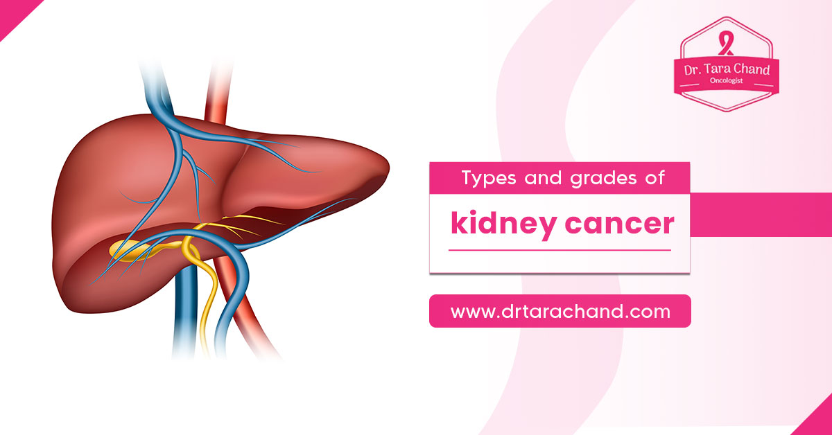 Types and grades of kidney cancer!